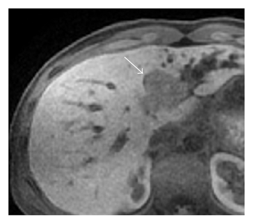 Details are in the caption following the image