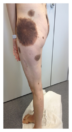Details are in the caption following the image Details are in the caption following the image