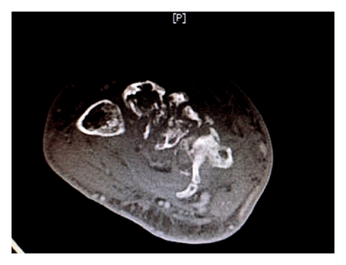 Details are in the caption following the image