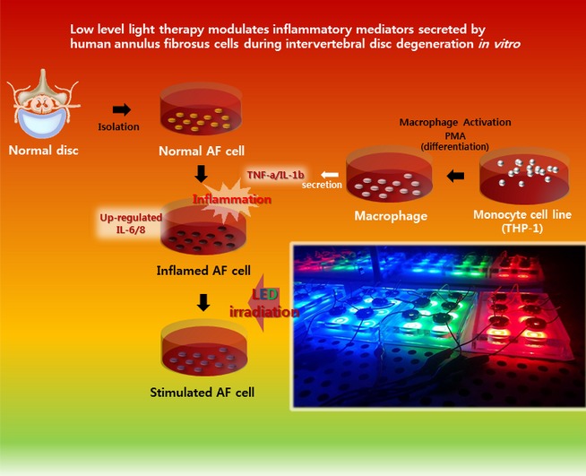 Low Level Light Therapy Modulates Inflammatory Mediators Secreted by Human Annulus Fibrosus Cells during Intervertebral Disc Degeneration In Vitro