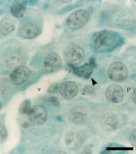 Details are in the caption following the image