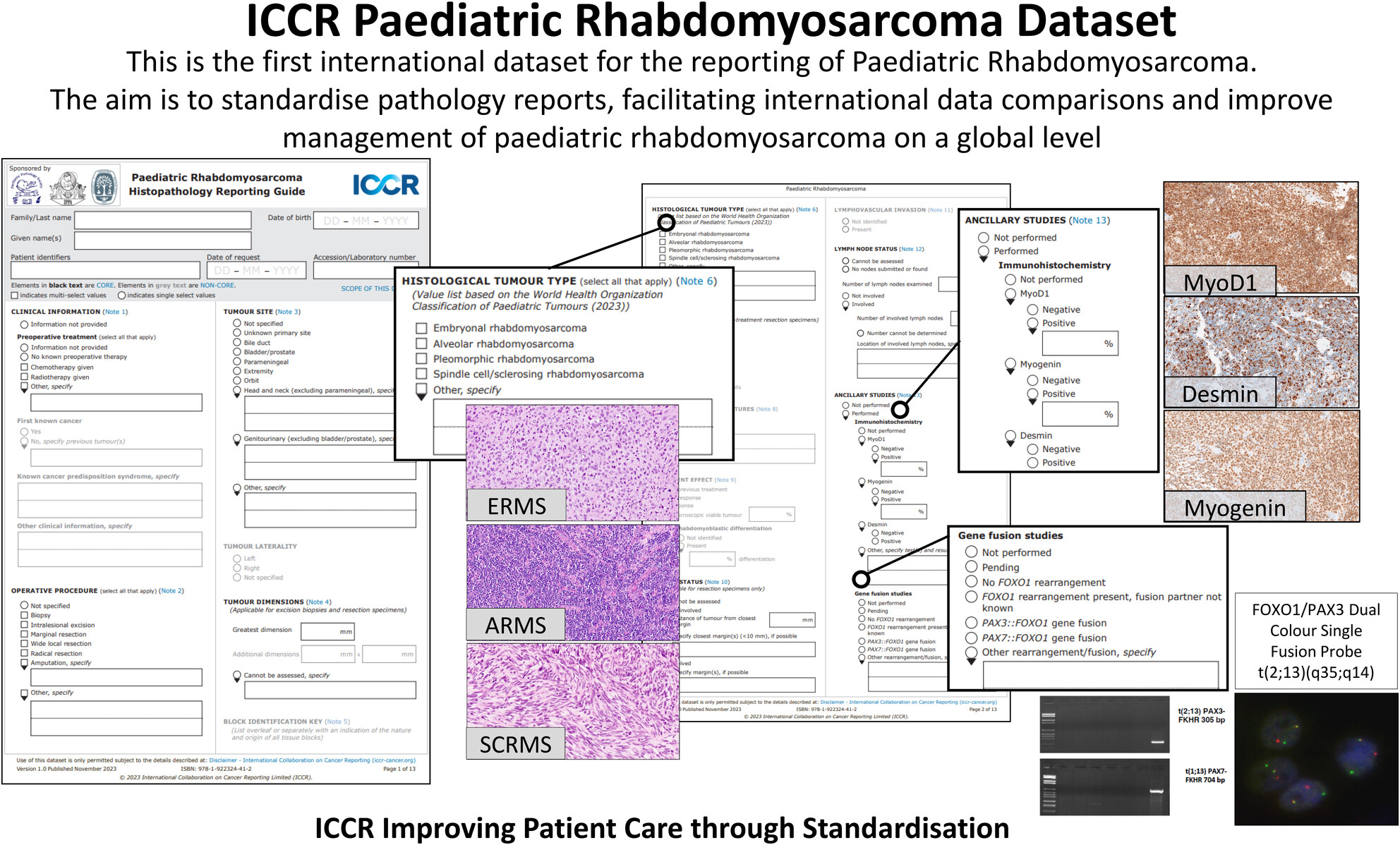 Data set for reporting of paediatric rhabdomyosarcoma: recommendations from the International Collaboration on Cancer Reporting (ICCR)