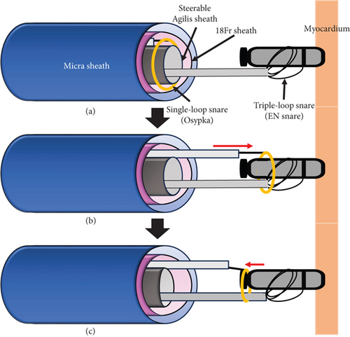 Details are in the caption following the image