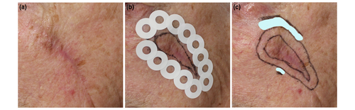 Details are in the caption following the image Details are in the caption following the image
