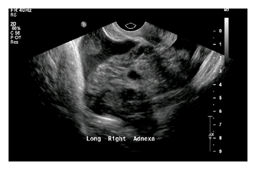 Details are in the caption following the image Details are in the caption following the image