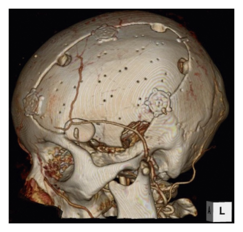 Details are in the caption following the image Details are in the caption following the image