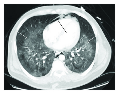 Details are in the caption following the image Details are in the caption following the image