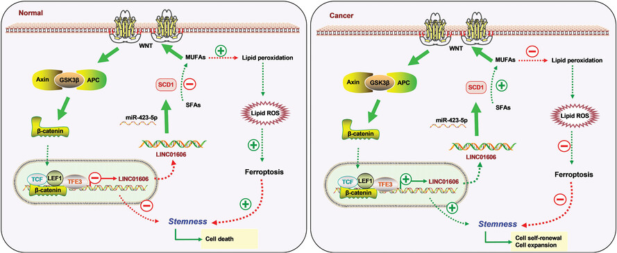 Long noncoding RNA LINC01606 protects colon cancer cells from ferroptotic cell death and promotes stemness by SCD1–Wnt/β-catenin–TFE3 feedback loop signalling