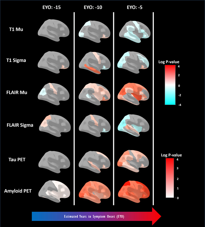 T1 and FLAIR signal intensities are related to tau pathology in dominantly inherited Alzheimer disease