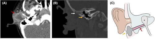 Details are in the caption following the image