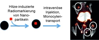 Heat-Induced Radiolabeling of Nanoparticles for Monocyte Tracking by PET