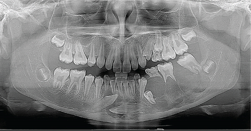 Details are in the caption following the image Details are in the caption following the image