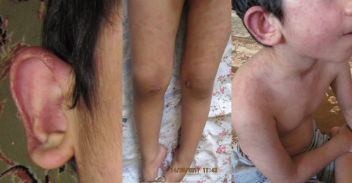 Details are in the caption following the image Details are in the caption following the image