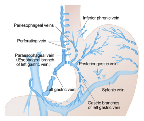 Details are in the caption following the image