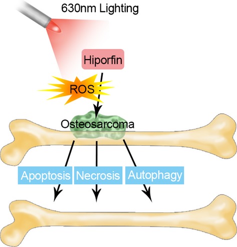 Hiporfin-Mediated Photodynamic Therapy in Preclinical Treatment of Osteosarcoma