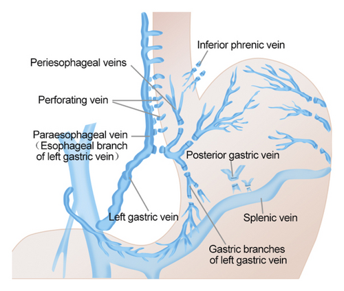 Details are in the caption following the image