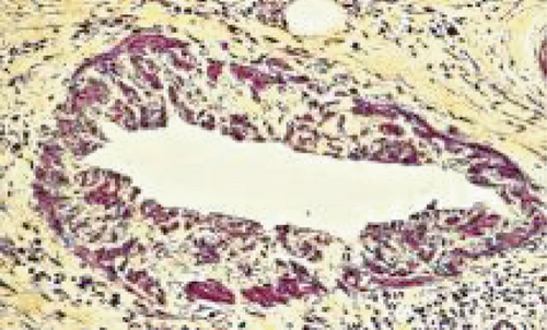 Details are in the caption following the image