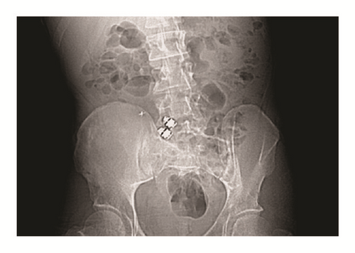 Details are in the caption following the image Details are in the caption following the image