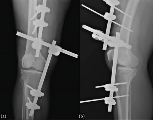Details are in the caption following the image Details are in the caption following the image