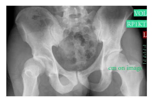 Details are in the caption following the image