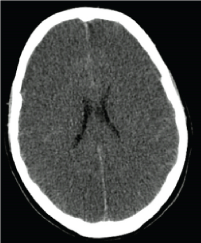 Details are in the caption following the image