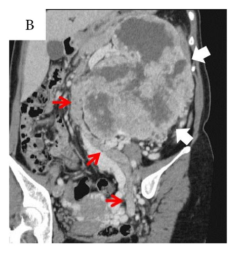 Details are in the caption following the image Details are in the caption following the image