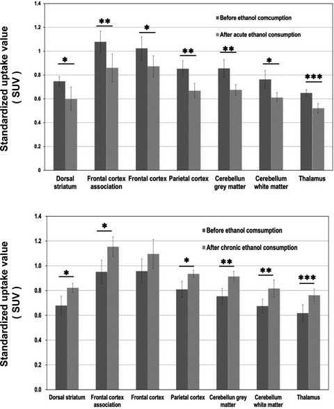 Effects of the Acute and Chronic Ethanol Intoxication on Acetate Metabolism and Kinetics in the Rat Brain