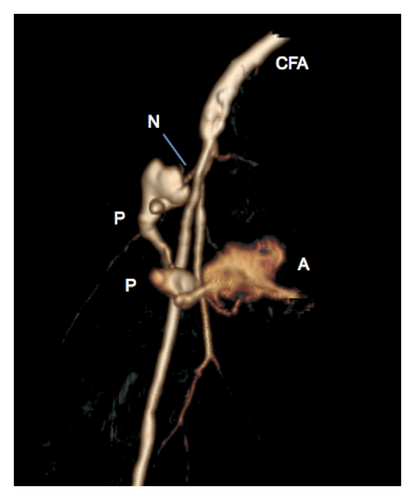 Details are in the caption following the image