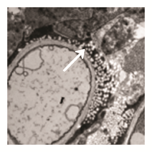 Details are in the caption following the image