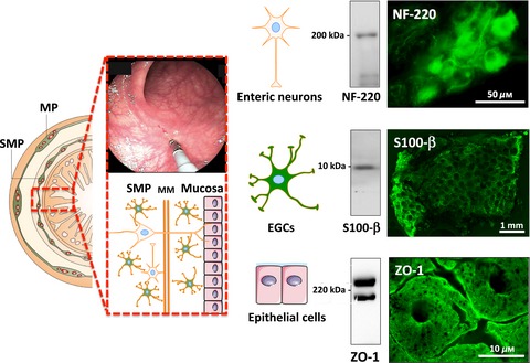 What a gastrointestinal biopsy can tell us about Parkinson's disease?