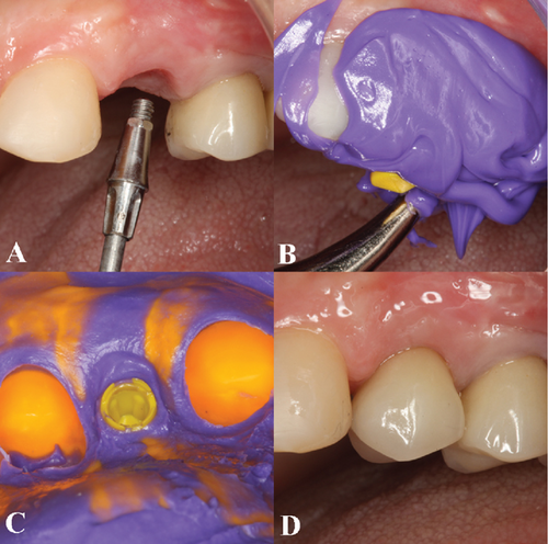 Details are in the caption following the image Details are in the caption following the image