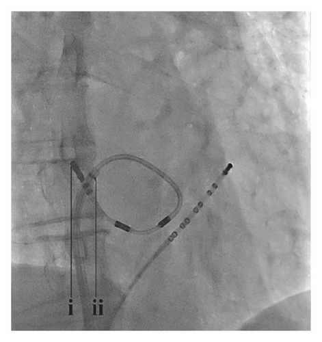 Details are in the caption following the image