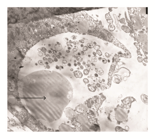 Details are in the caption following the image