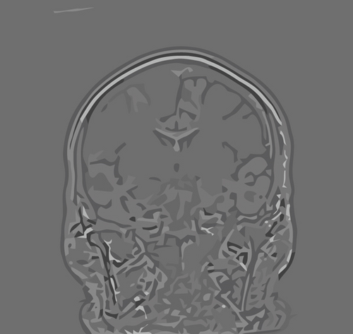Details are in the caption following the image