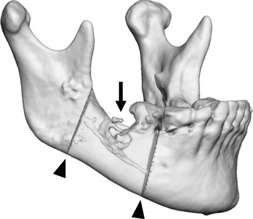 Details are in the caption following the image Details are in the caption following the image