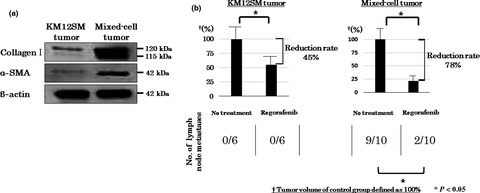 Multikinase inhibitor regorafenib inhibits the growth and metastasis of colon cancer with abundant stroma