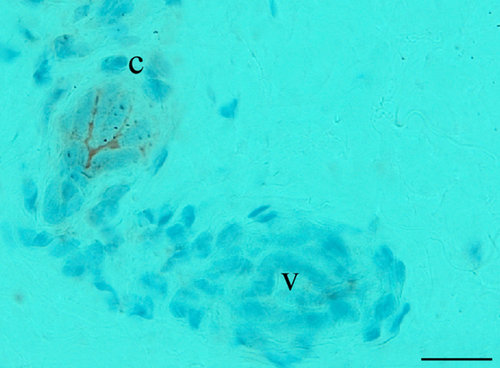 Details are in the caption following the image