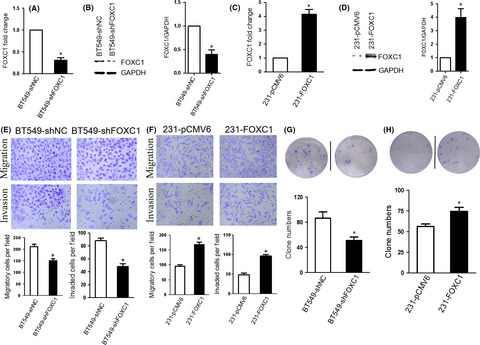 Forkhead box C1 boosts triple-negative breast cancer metastasis through activating the transcription of chemokine receptor-4