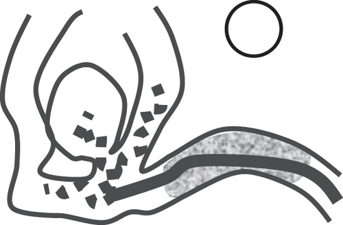 Details are in the caption following the image