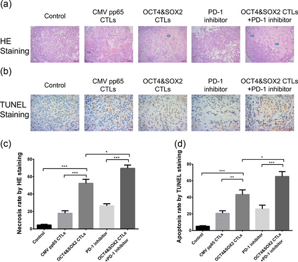 OCT4&SOX2-specific cytotoxic T lymphocytes plus programmed cell death protein 1 inhibitor presented with synergistic effect on killing lung cancer stem-like cells in vitro and treating drug-resistant lung cancer mice in vivo