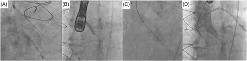 Details are in the caption following the image Details are in the caption following the image