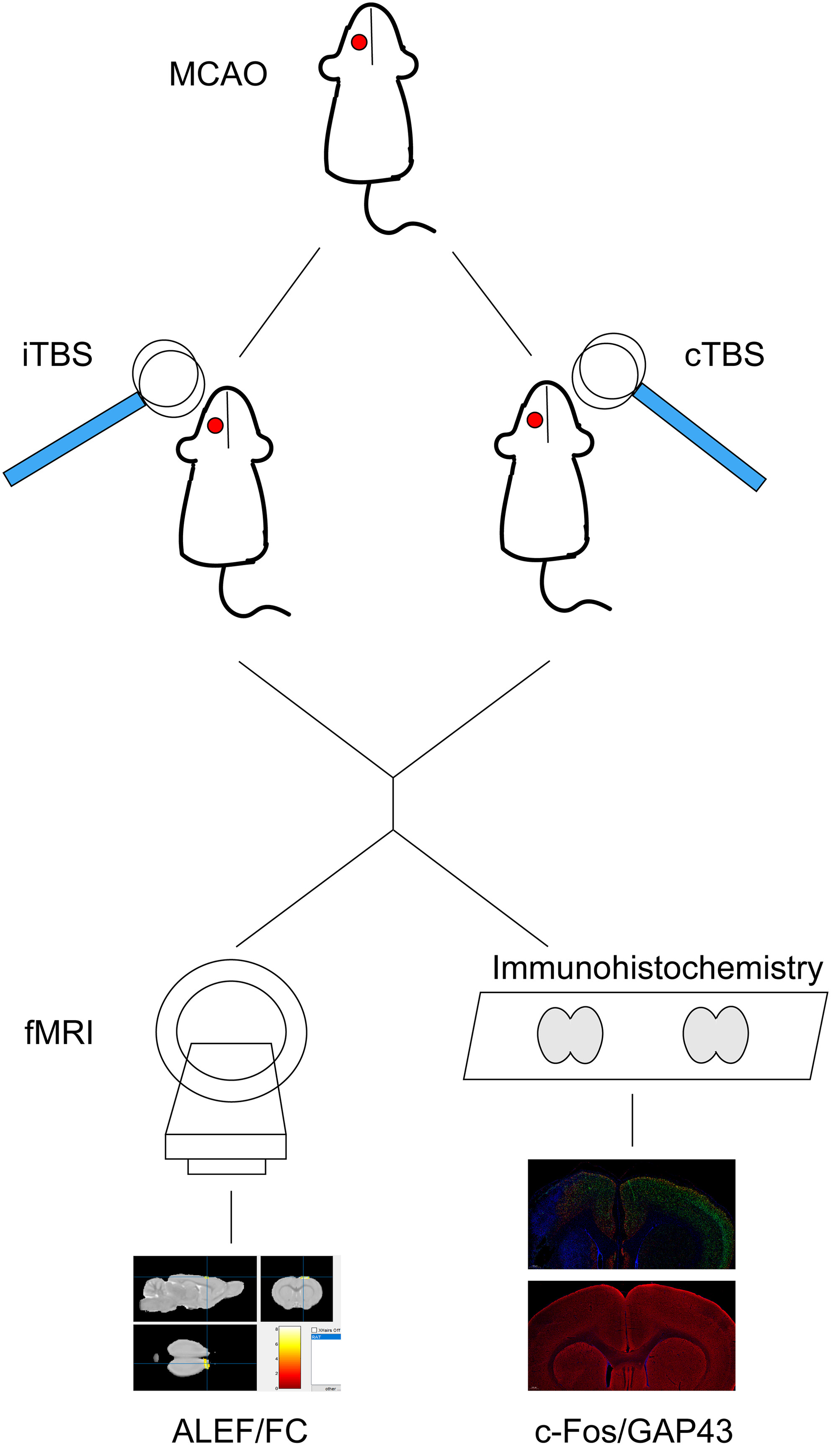 Resting-State Functional Magnetic Resonance Imaging Reveals the Effects of rTMS on Neural Activity and Brain Connectivity After Experimental Stroke