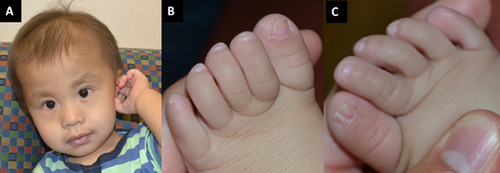 Details are in the caption following the image Details are in the caption following the image