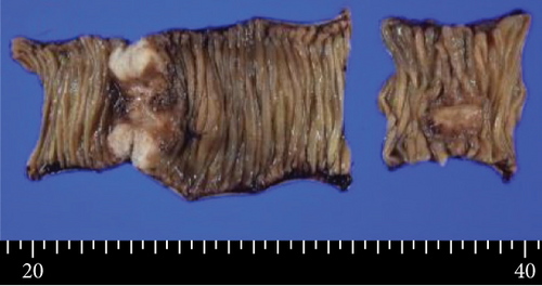 Details are in the caption following the image