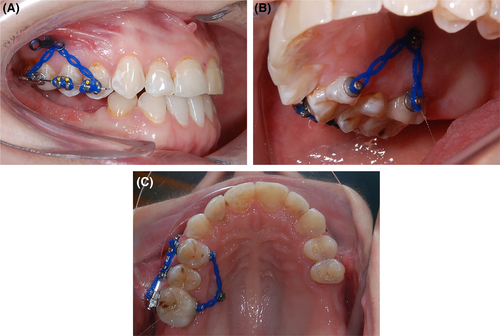 Details are in the caption following the image Details are in the caption following the image