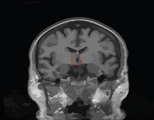 Details are in the caption following the image