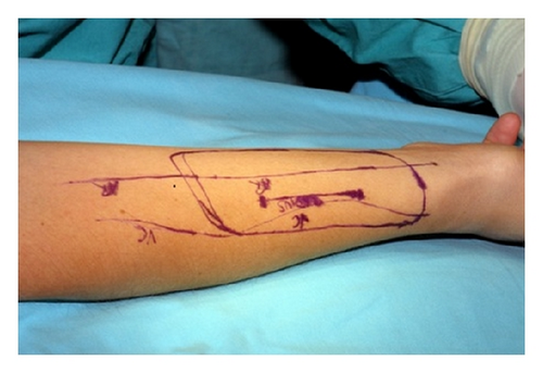 Details are in the caption following the image Details are in the caption following the image