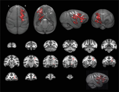 Sex differences in white matter tracts of capuchin monkey brains