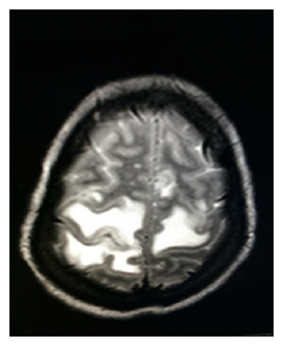 Details are in the caption following the image