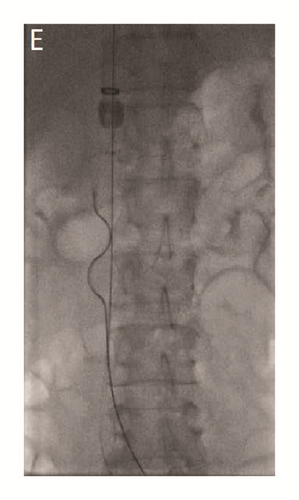 Details are in the caption following the image